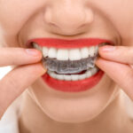 Closeup of woman putting in her Invisalign aligners while wearing red lipstick in Weatherford, TX
