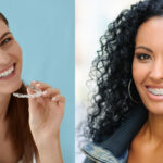 Two women, one with Invisalign clear aligners and the other wearing braces, which have different cleaning techniques