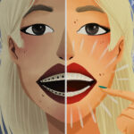 Illustration of a blonde woman with Invisalign on half her smile to compare with braces